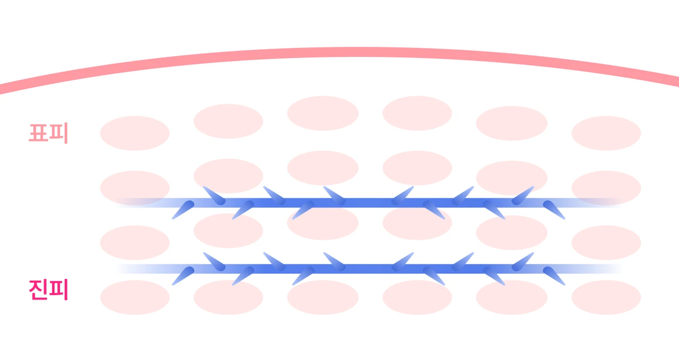 Concertina-2